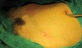 山东省立医院预约挂号 山东省立医院预约挂号